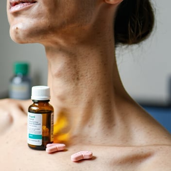 A close-up of a woman's neck with a bottle of liquid medication and tablets resting on her collarbones.